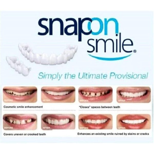 Snap-On Smile Fake Teeth