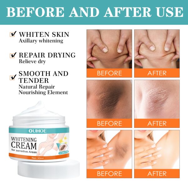 Ouhoe Whitening Cream for Sensitive Areas